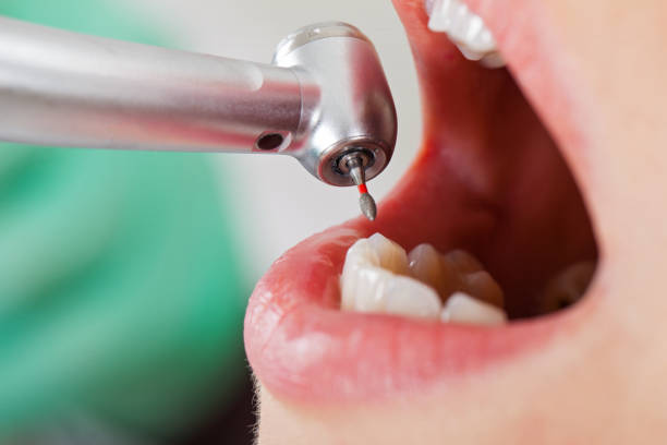 Best Tooth Pain Emergency Relief  in Marseles, IL